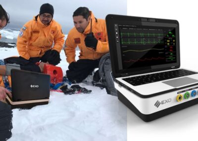 CDM Centro de Diagnóstico Móvil EXO